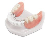 Partial Denture Palos Verdes CA